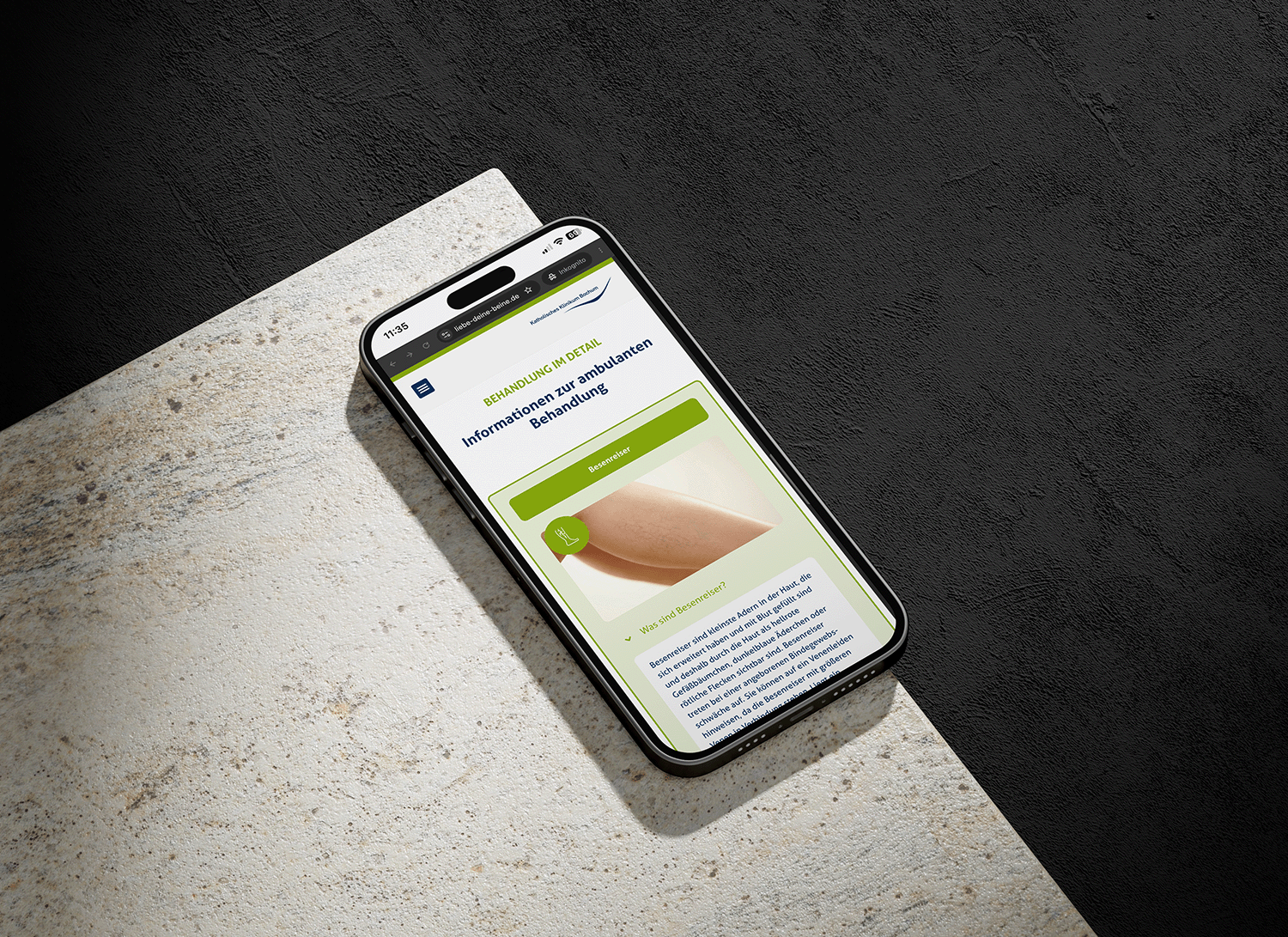 Mockup-Smartphone-Venenzentrum-04